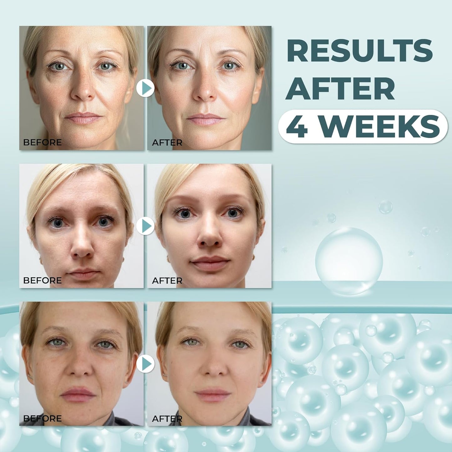 Abera Anti-Wrinkle Face Cream | Hydrating Anti-Aging Moisturizer for Fine Lines & Sensitive Skin