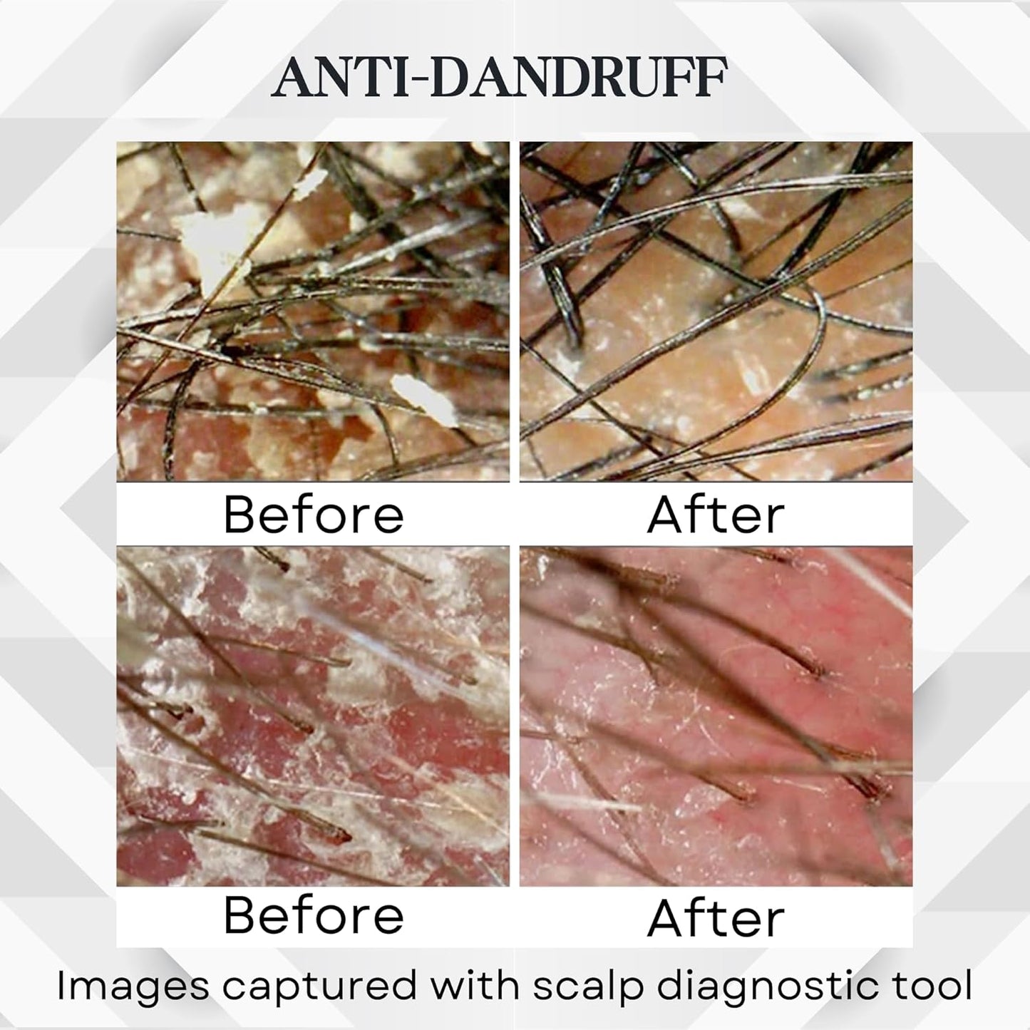 Abera Amanda Anti-Dandruff Shampoo | Nourishing Formula for Stronger Hair & Healthy Scalp