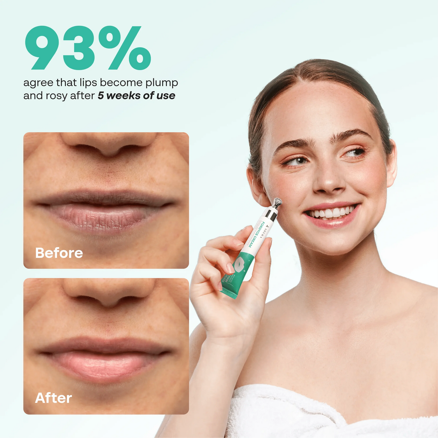 Abera Fordyce Cream | HPR Retinoid Formula for Fordyce Spots, Lip Acne & Dark Lips Care