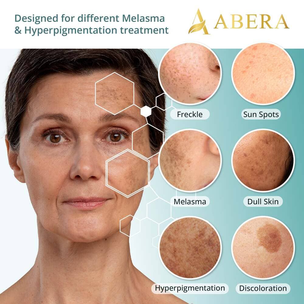 Abera Melasma Serum Plus, Advanced Dark Spot Corrector for Clear, Even, Radiant Skin