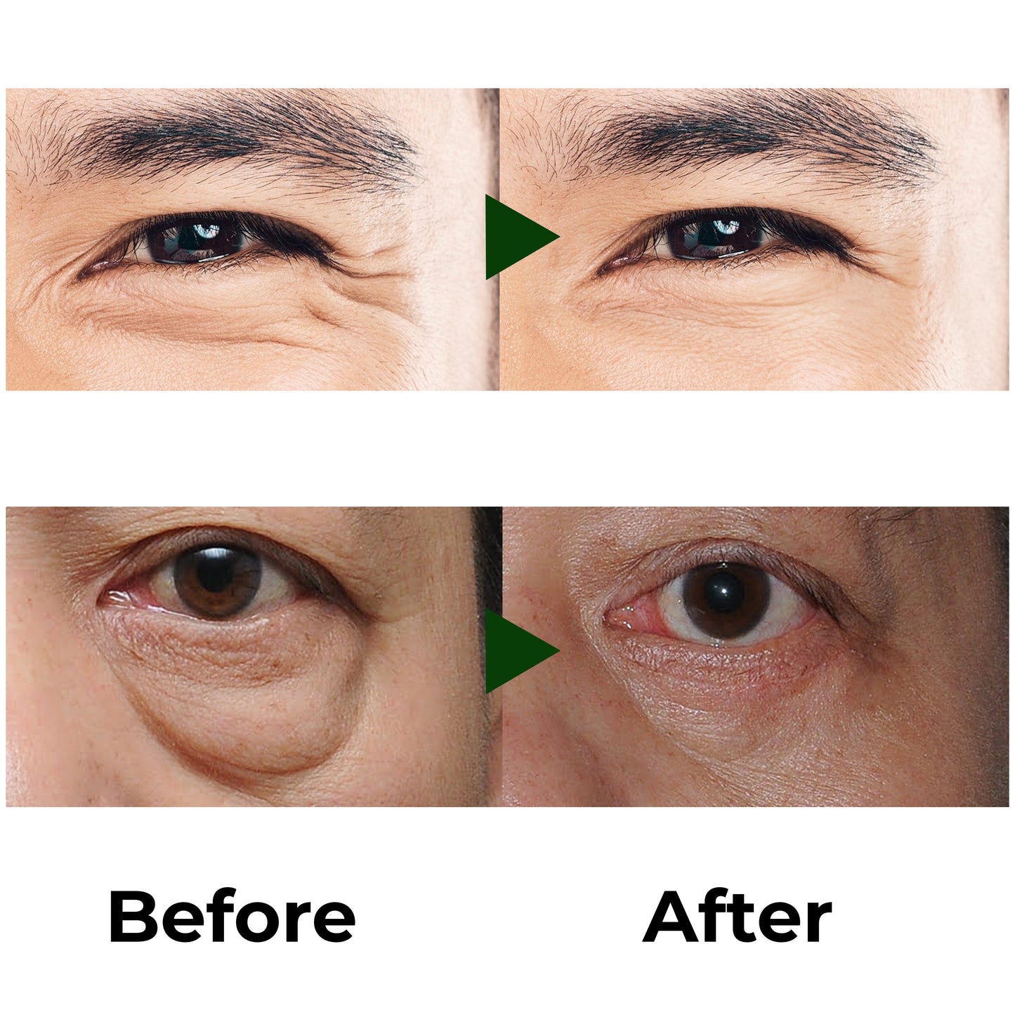Abera Eye Roller Serum | Cooling Treatment for Eye Bags, Puffiness & Dark Circles