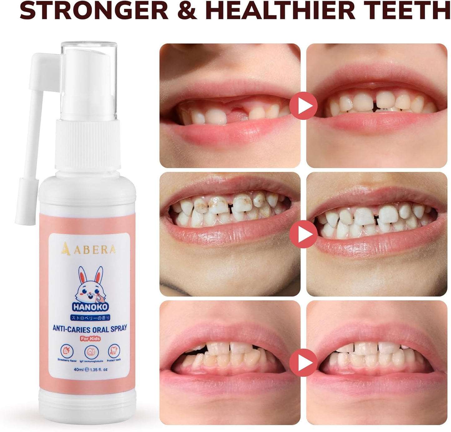 Abera Anti-Caries Kids Oral Spray | Gentle Tooth Care for Babies, Toddlers & Kids