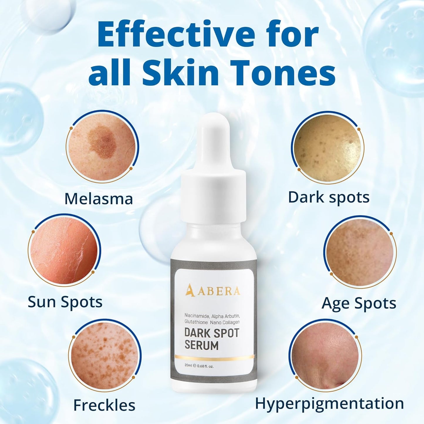 Abera Dark Spot Serum for Face, Dark Spot Corrector, Melasma & Age Spot Treatment
