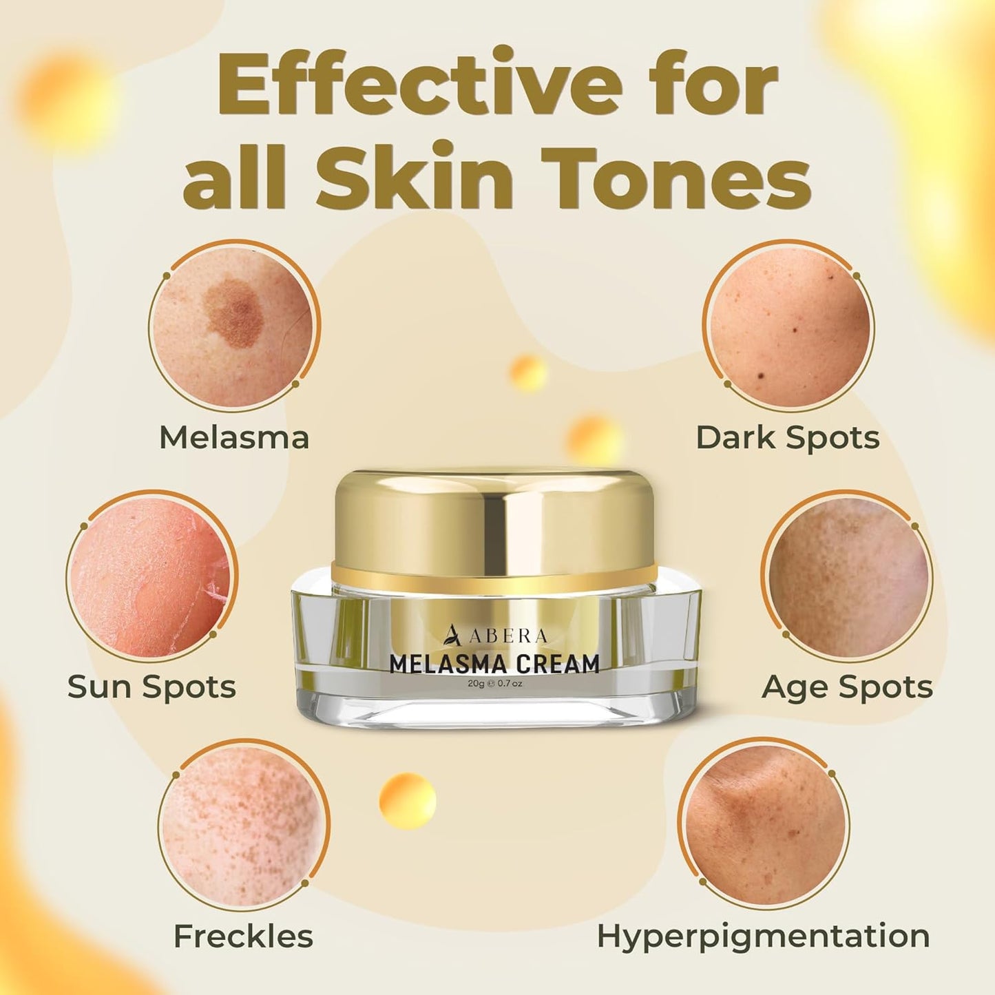 Abera Melasma Cream Premium | Advanced Dark Spot Corrector for Melasma, Freckles & Sun Spots
