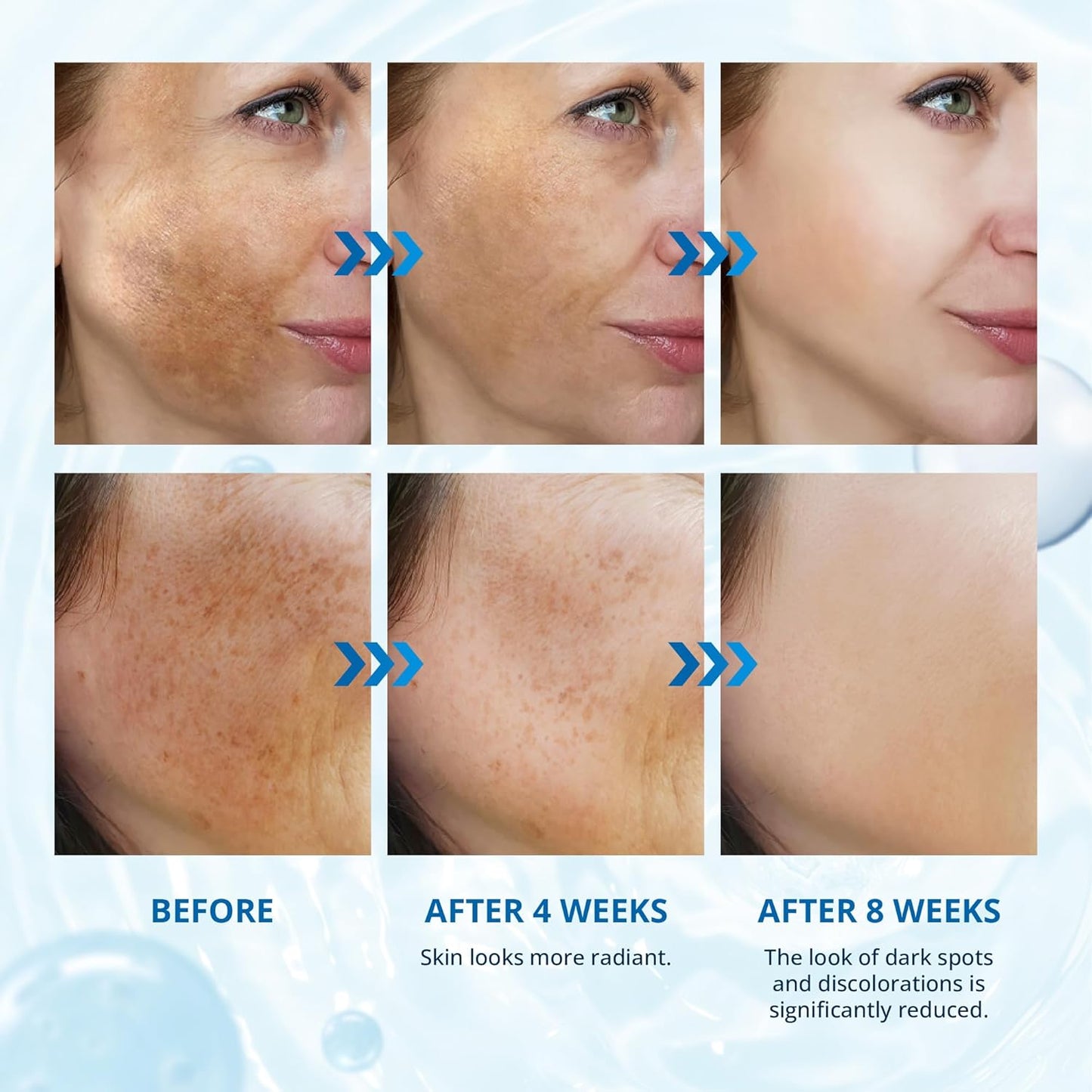 Abera Dark Spot Serum for Face, Dark Spot Corrector, Melasma & Age Spot Treatment