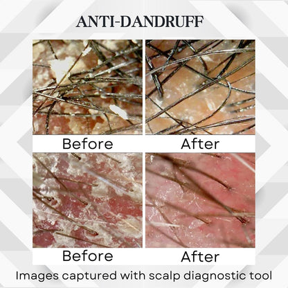 Abera Amanda Anti-Dandruff Shampoo | Nourishing Formula for Stronger Hair & Healthy Scalp