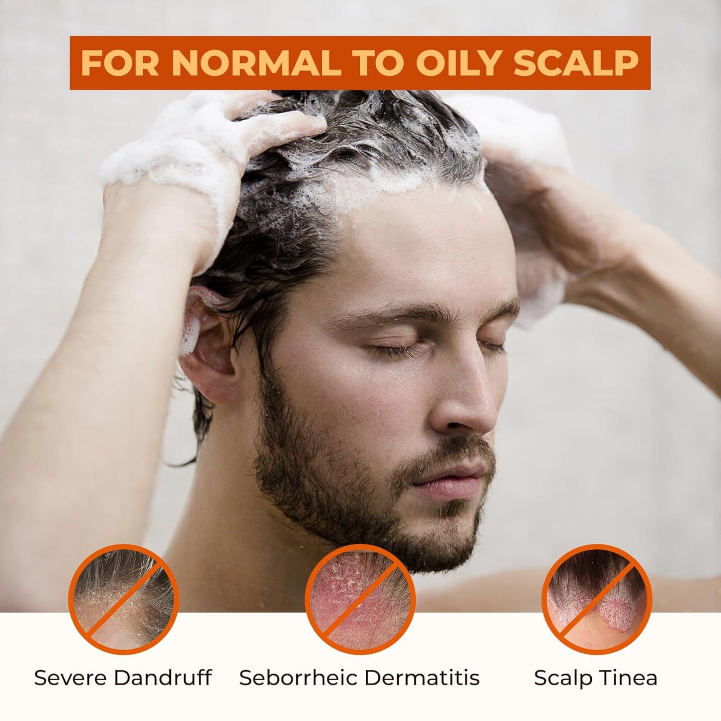 Abera Anti-Dandruff Shampoo | Nourishing Formula for Healthy Scalp & Stronger Hair Growth