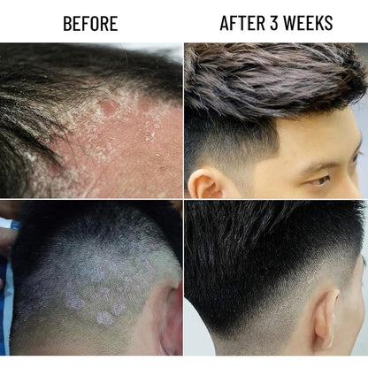 Abera Amanda Anti-Dandruff Shampoo | Nourishing Formula for Stronger Hair & Healthy Scalp