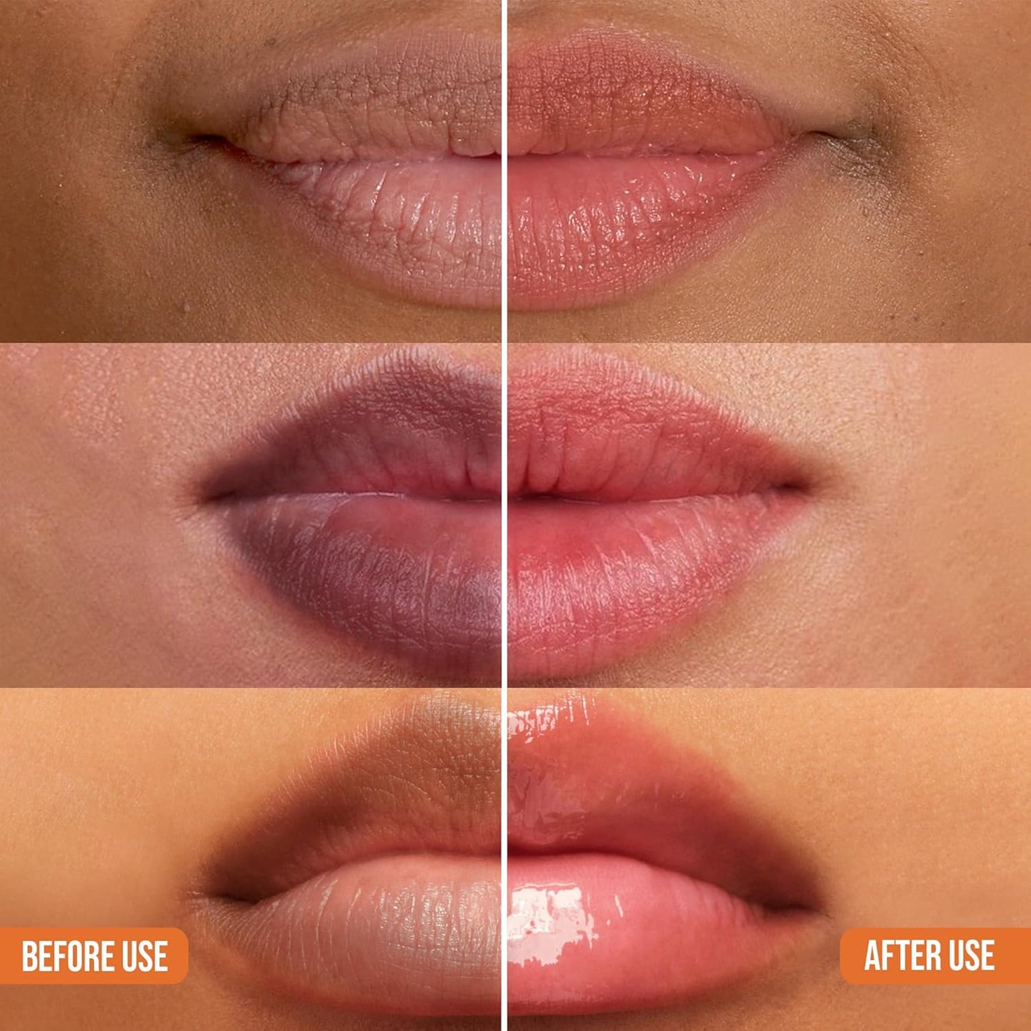 Abera Dark Lips Corrector Cream | Brightening Lip Balm & Moisturizer for Smooth, Soft Lips