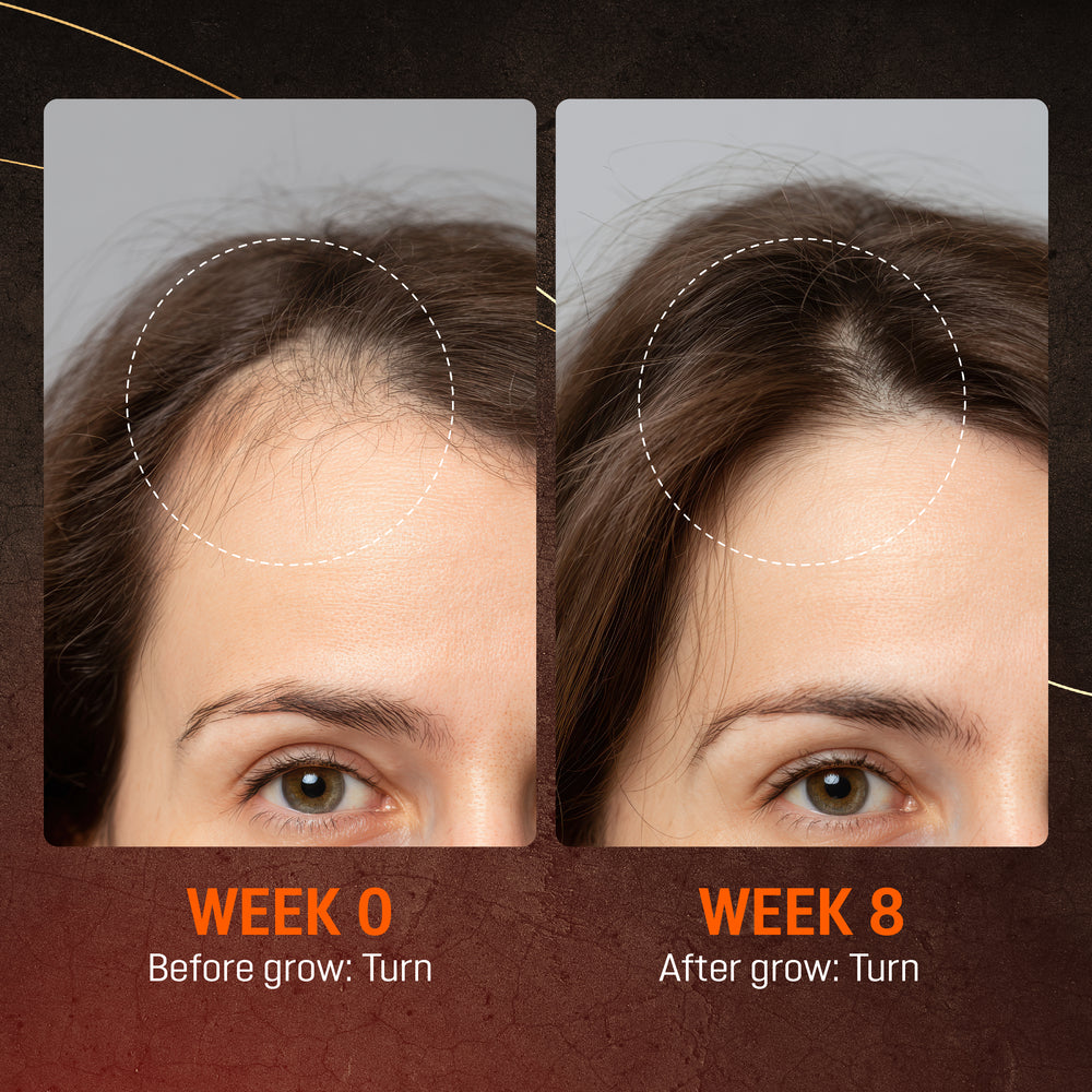 Abera Hair Serum with Redensyl Drug-Free Hair Thickening Serum