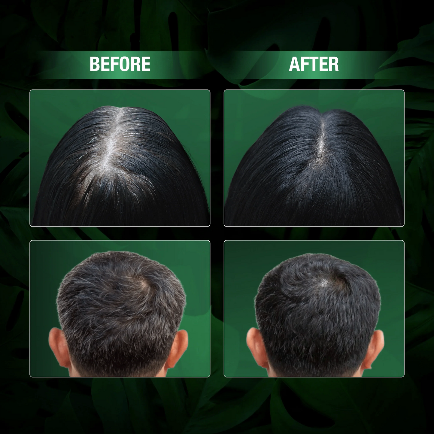 Abera Hair Dye Shampoo | One-Wash Black Hair Color for Grey Coverage with Natural Dark Tone