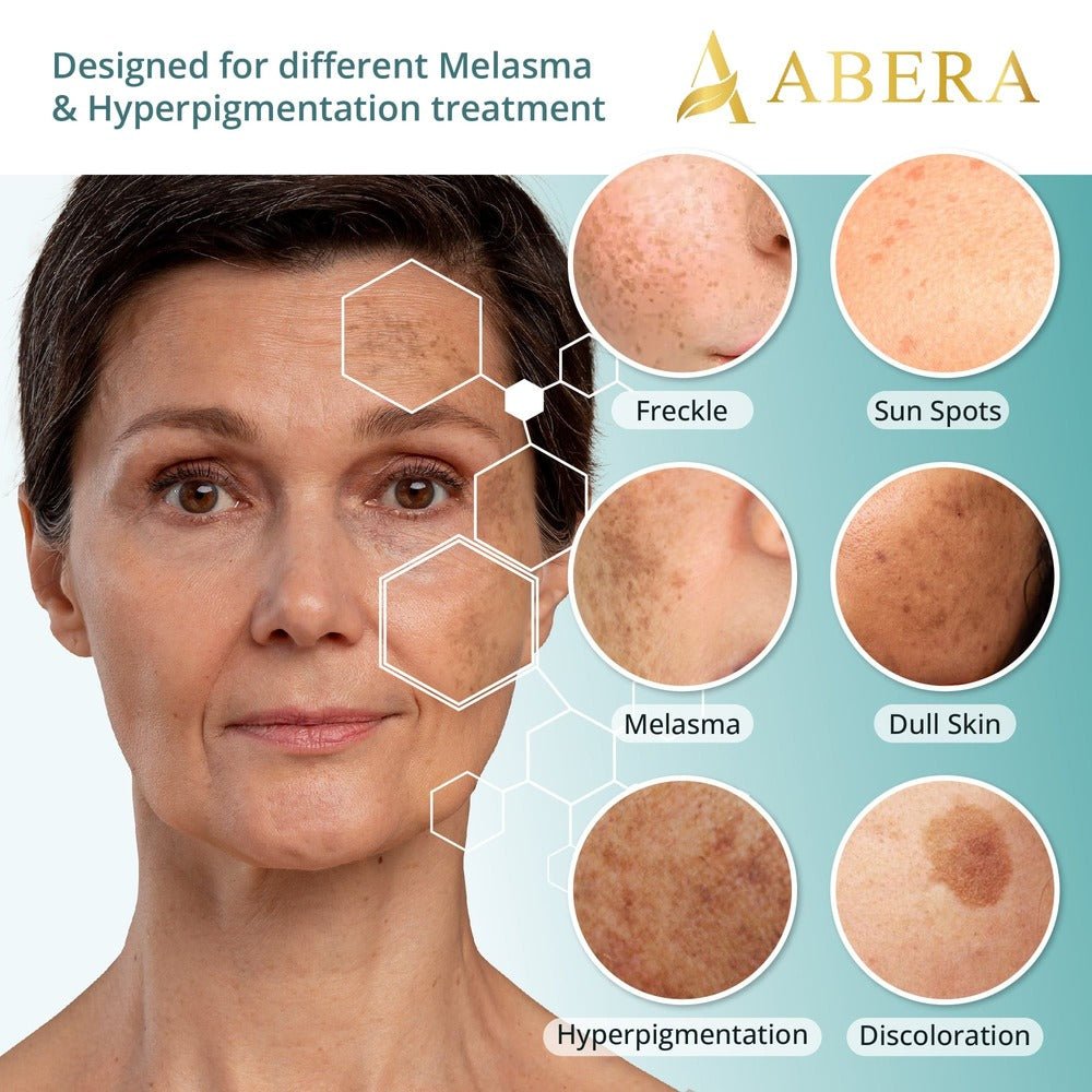 Abera Melasma Serum | Advanced Dark Spot Corrector & Melasma Treatment for Radiant Skin