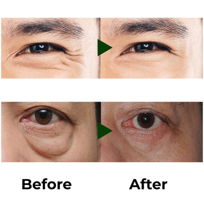 Abera Eye Roller Serum | Cooling Treatment for Eye Bags, Puffiness & Dark Circles